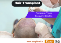 What is Hair Transplant